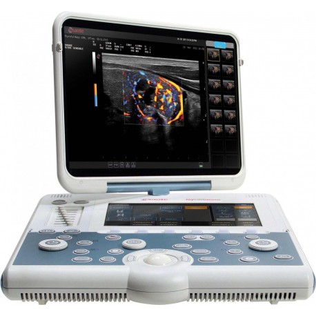 Esaote MyLab Gamma Multipurpose Portable Ultrasound