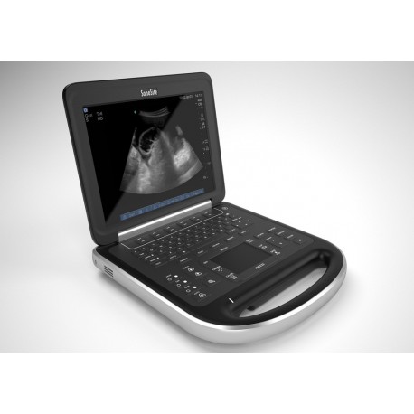 Sonosite Edge Portable Ultrasound