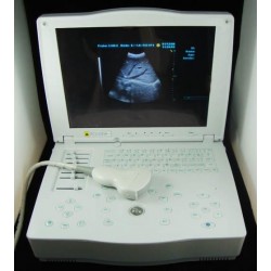 Laptop Ultrasound Scanner with Convex Transducer